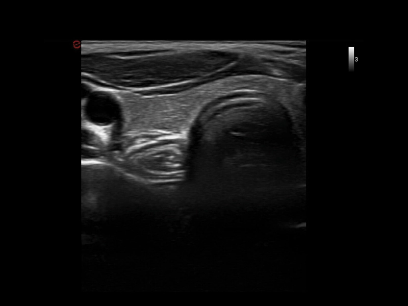 MyLab™X1 Go - General Imaging 03