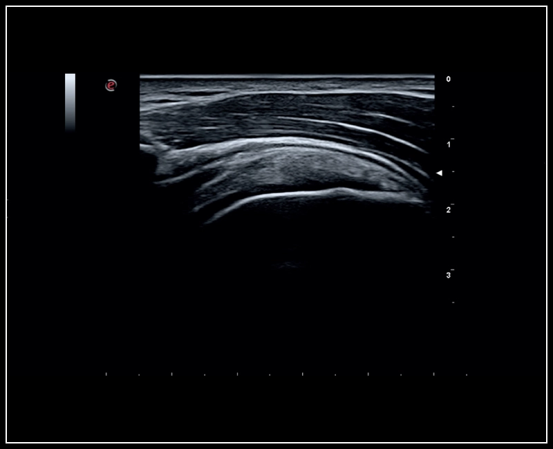 MyLab™Sigma - MSK imaging of the shoulder