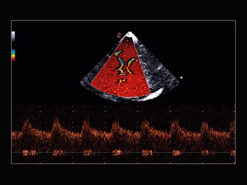 MyLab™X9 - Shared Service 06