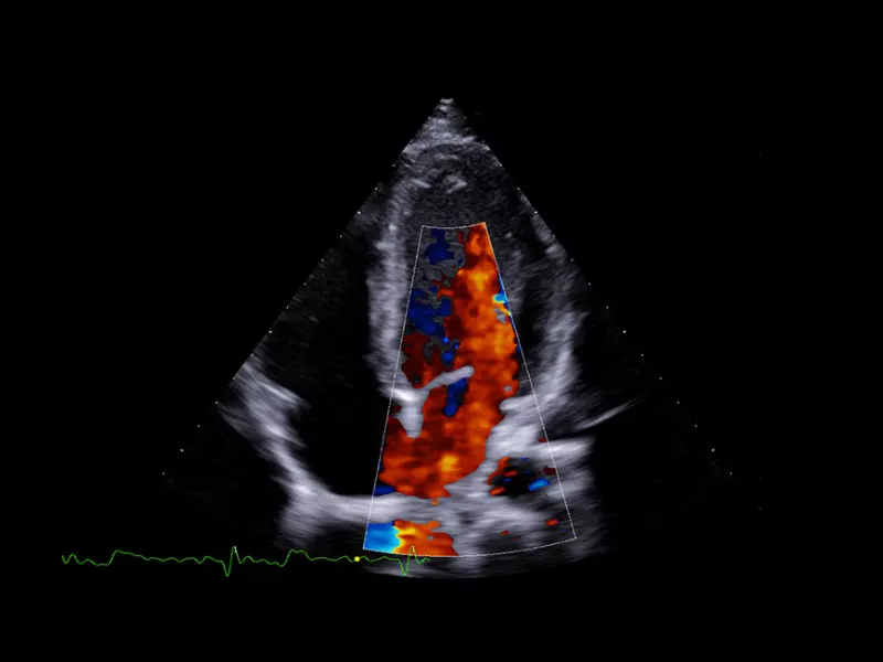 MyLab™X90 - Cardiovascular 04