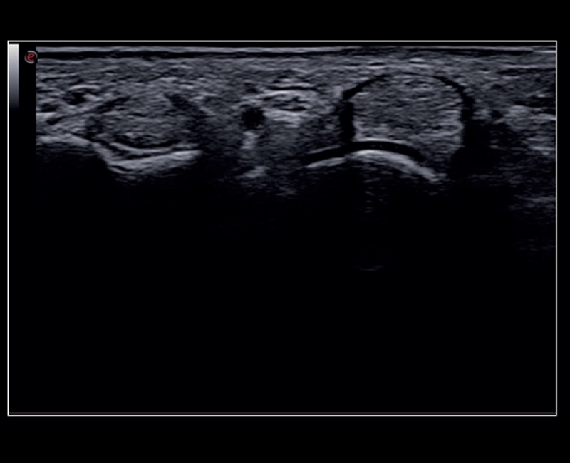 MyLab™X8 Platform - Very high frequency exploration of up to 24MHz