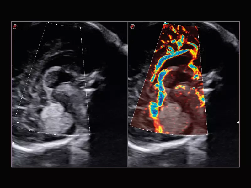 MyLab™X9 - Shared Service 12