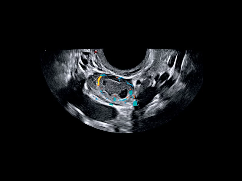 MyLab™X75 - Women's Health 02