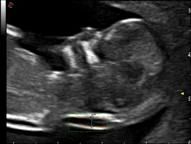 MyLab™ Omega - AutoNT