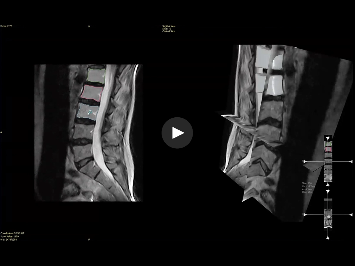 Computer assisted calculation of the following parameters