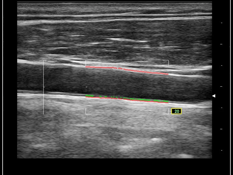 MyLab™Omega - RF QIMT
