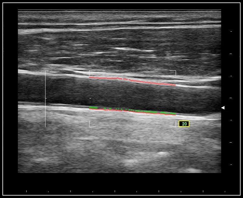 MyLab™Omega - RF QIMT