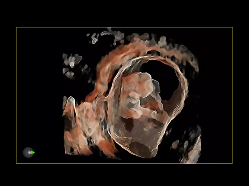 MyLab™X90 - Women's Health 03