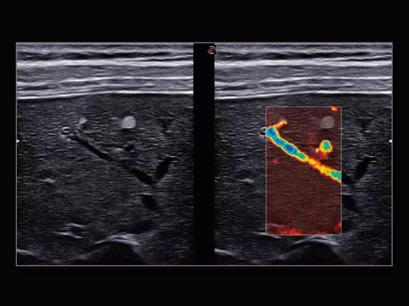 MyLab™X9 - Liver 04
