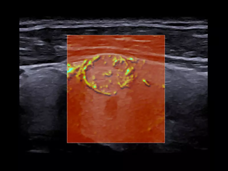 MyLab™X90 - General Imaging 01