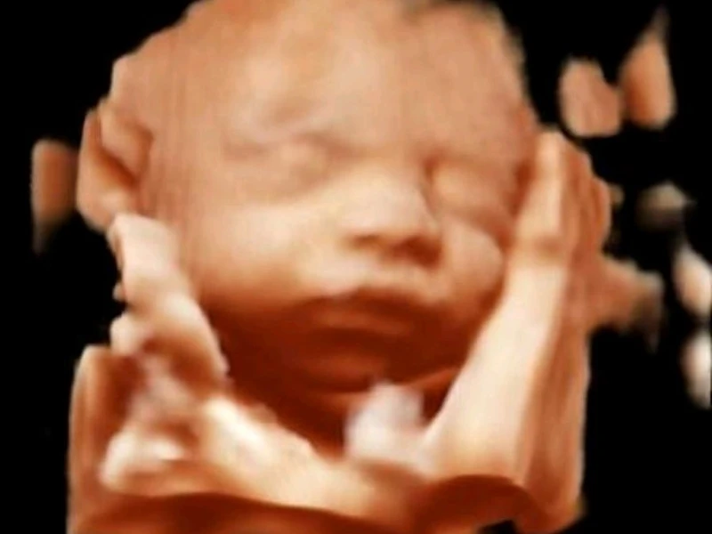 MyLab™Omega - BabyFace using XLight