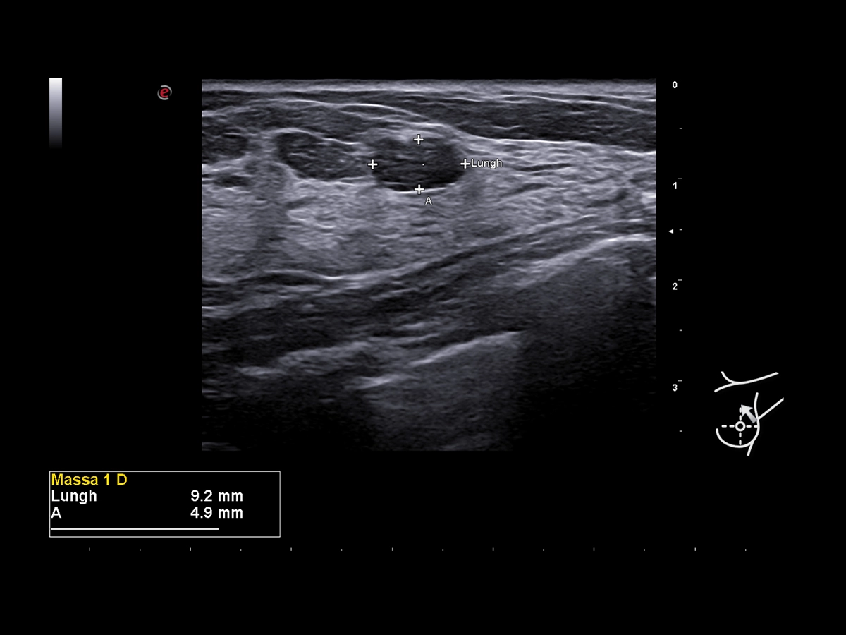 A.I.-based technologies for automatic lesion characterization