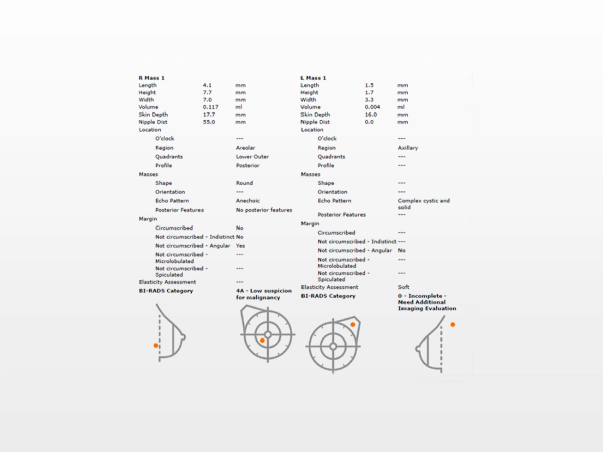 Comprehensive BI-RADS® Report