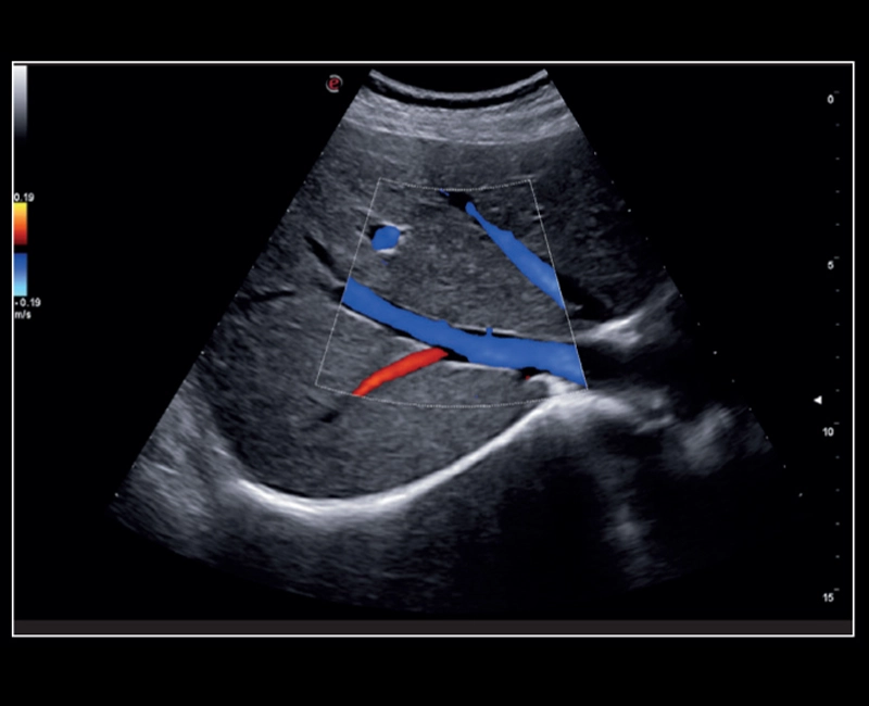 MyLab™X8 Platform - CPI with color Doppler