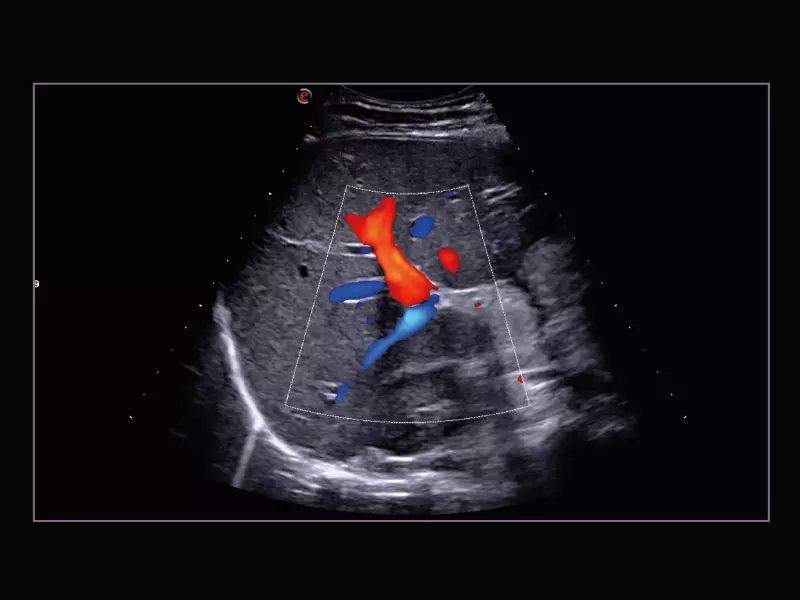 MyLab™X9 - Liver 03