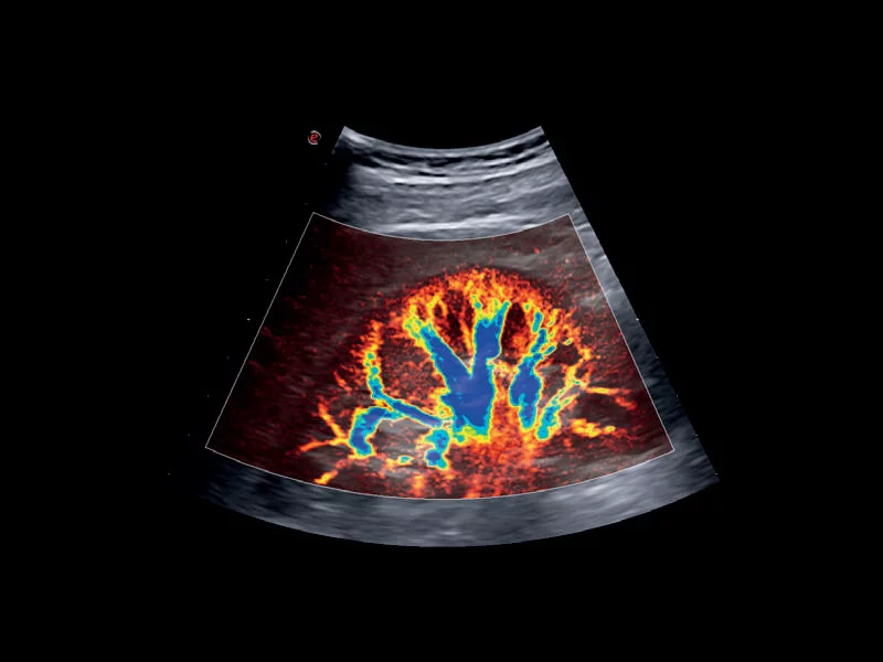 MyLab™X75 - General Imaging 02