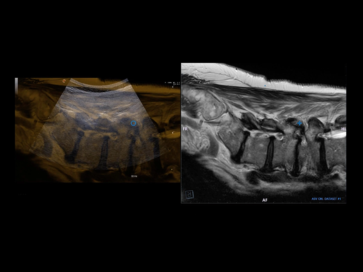 Interventional Procedures