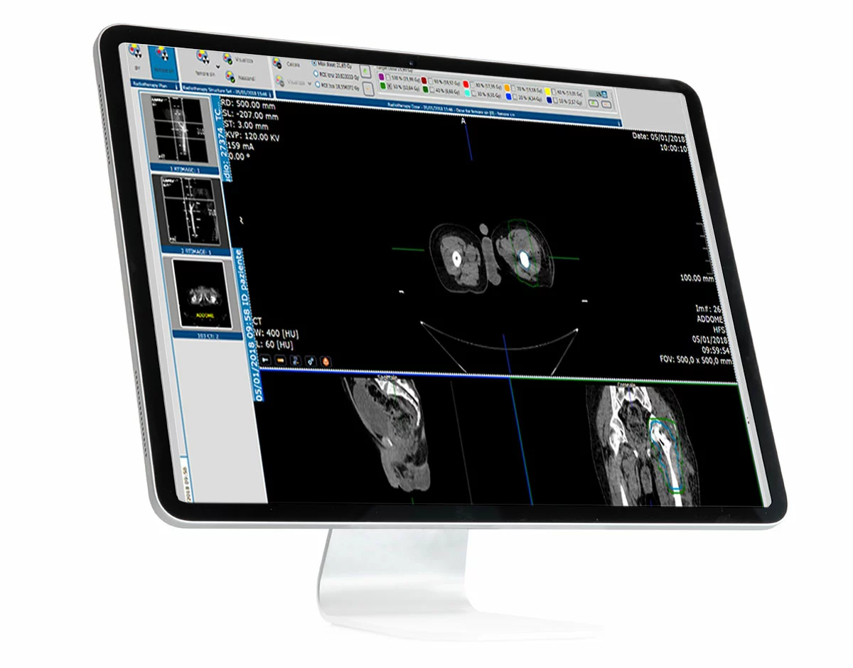 Suitestensa RT, enterprise imaging software