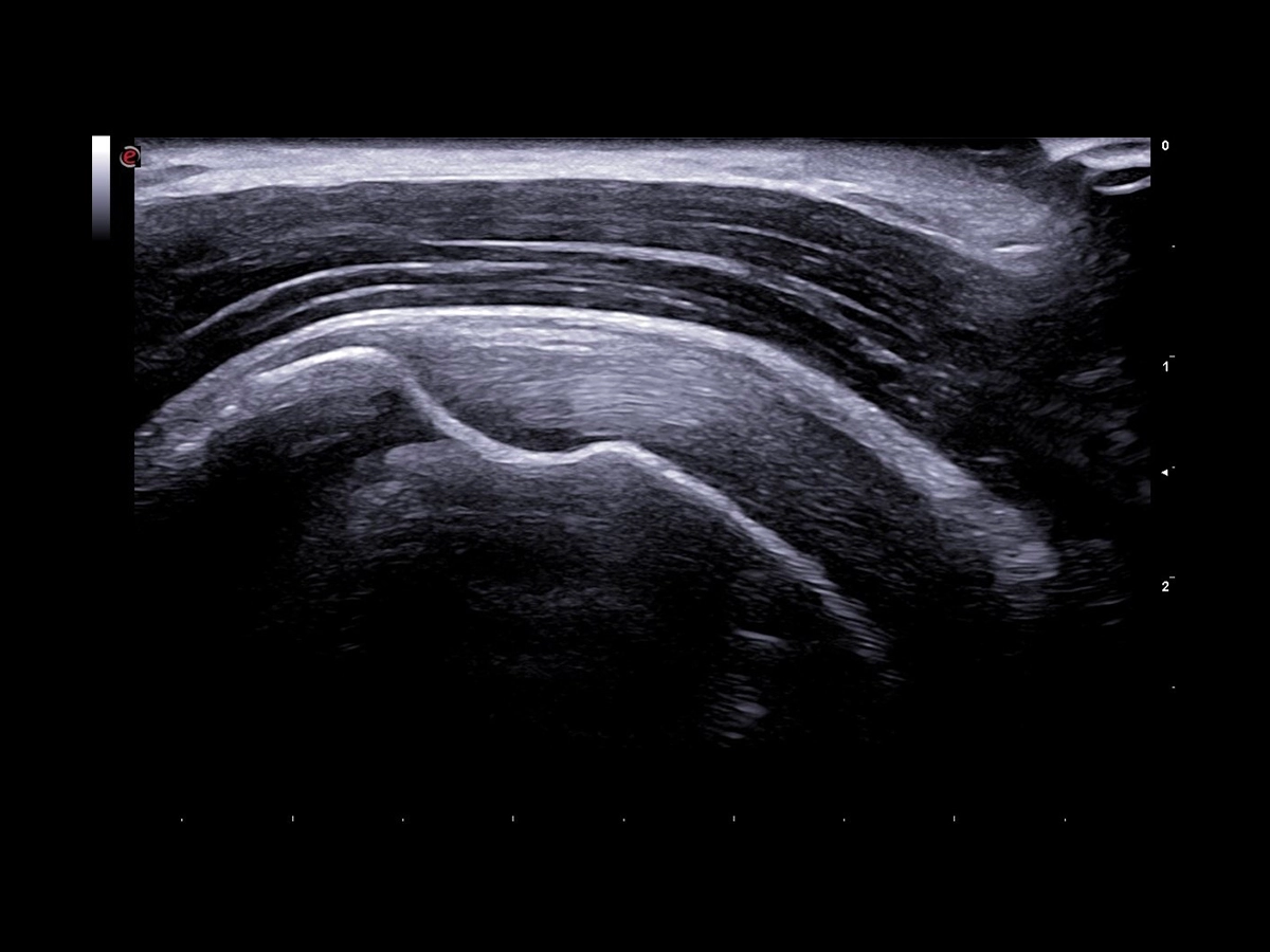 Wide probe portfolio