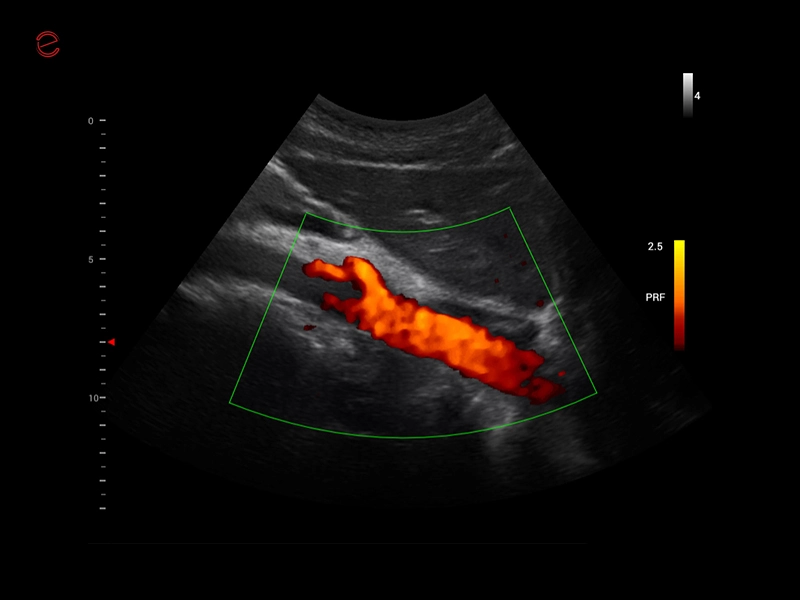 MyLab™X1 Go - POC 1