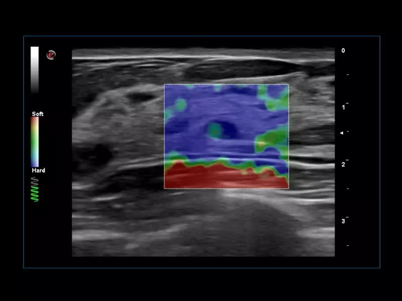 MyLab™Omega eXP - ElaXto