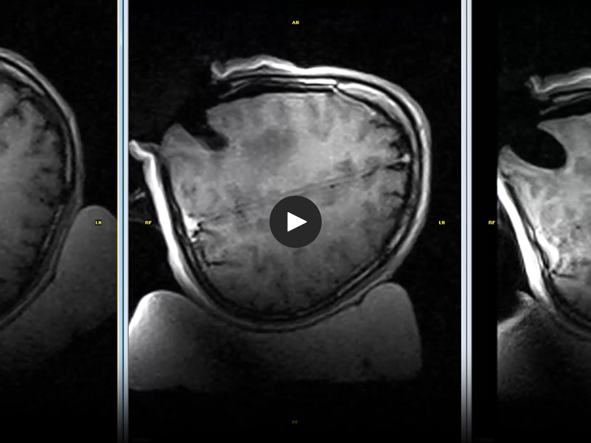 Esaote Confident vision for smarter surgery