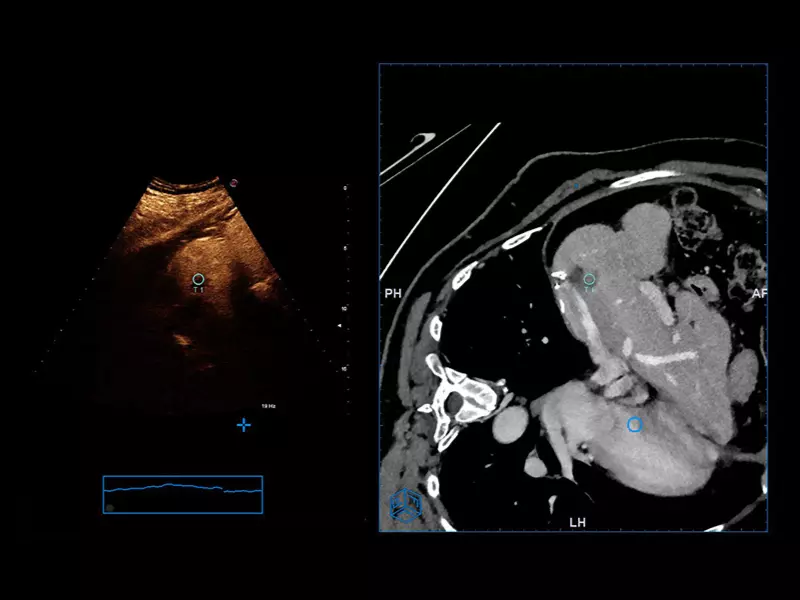 MyLab™X90 - General Imaging 02