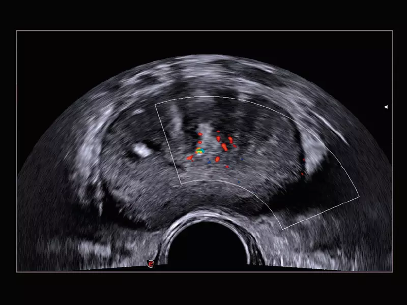MyLab™X9 - Urology 01