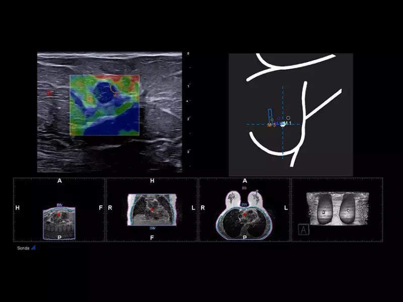 MyLab™X90 - Women's Health 02