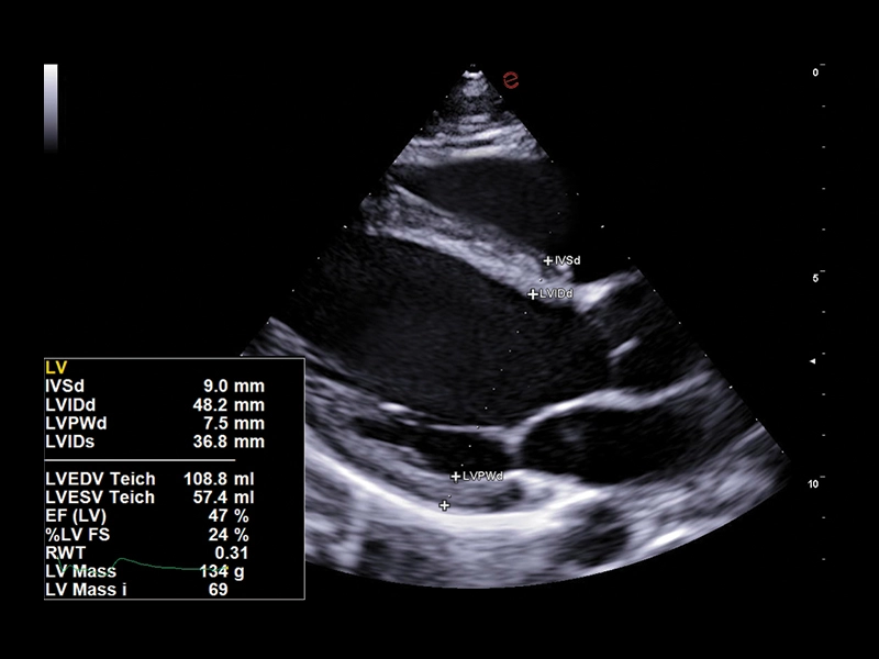 MyLab™A70 - AutoCM