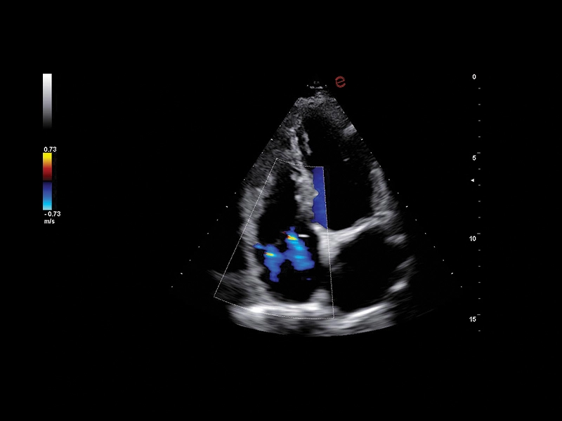 MyLab™A50 - Heart CFM