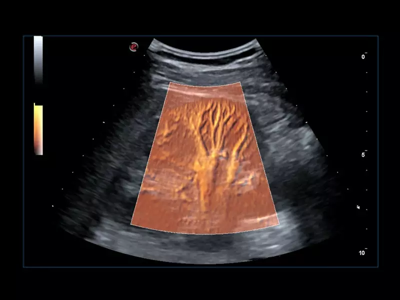 MyLab™Omega eXP - BrightFlow