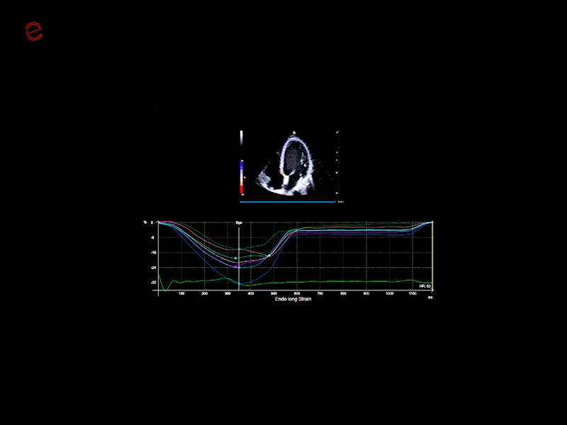 MyLab™C25 - Xstrain