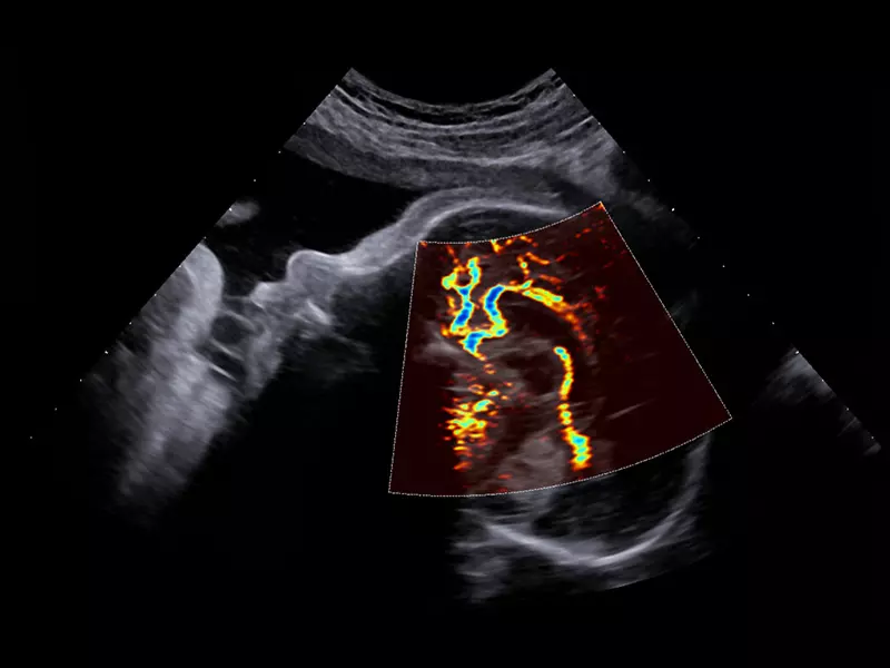 MyLab™X90 - Women's Health 05