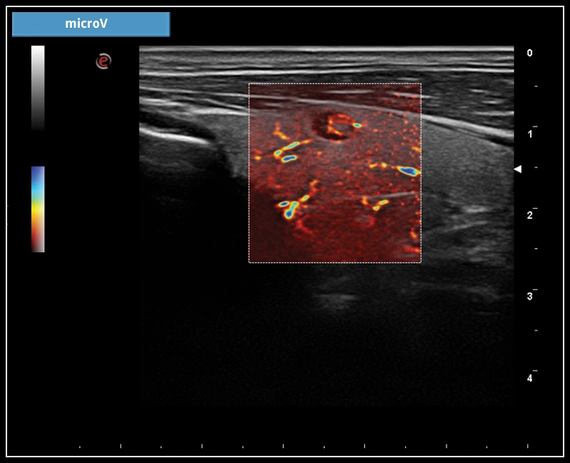 MyLab™X7 – microV