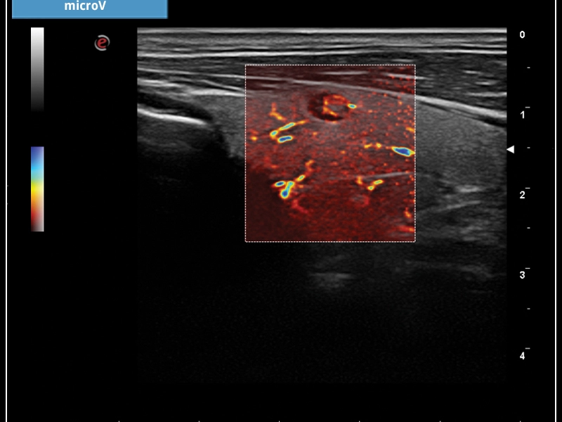 MyLab™X7 – microV