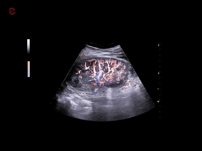 MyLab™C25 - X-FLOW 2