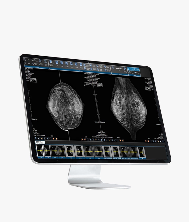 Suitestensa Review, enterprise imaging software