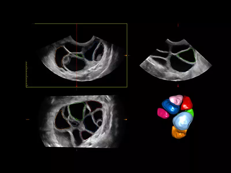 MyLab™X90 - Women's Health 01