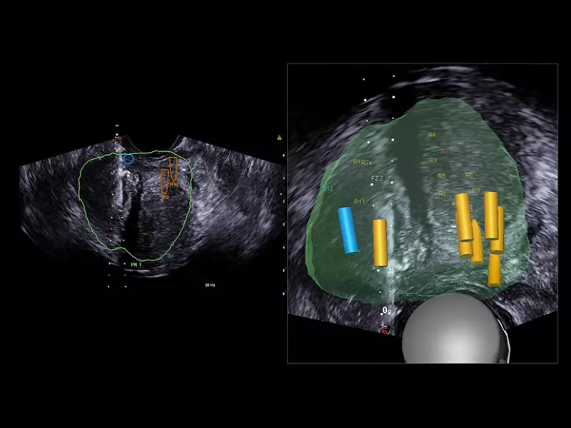 MyLab™X90 - Urology 01