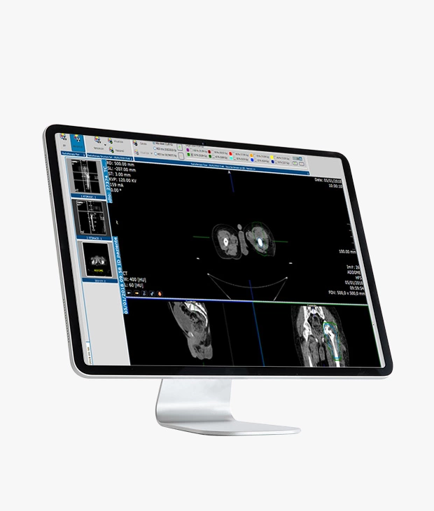 Suitestensa RT, enterprise imaging software