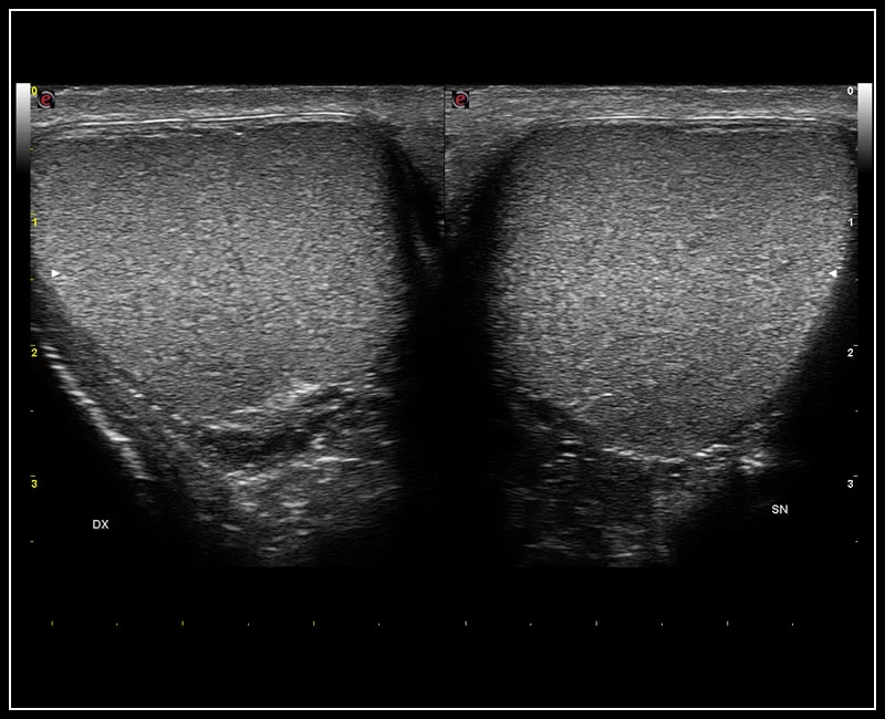 MyLab™9 Platform - High resolution imaging in testis