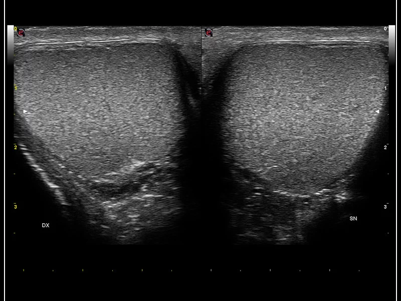 MyLab™9 Platform - High resolution imaging in testis