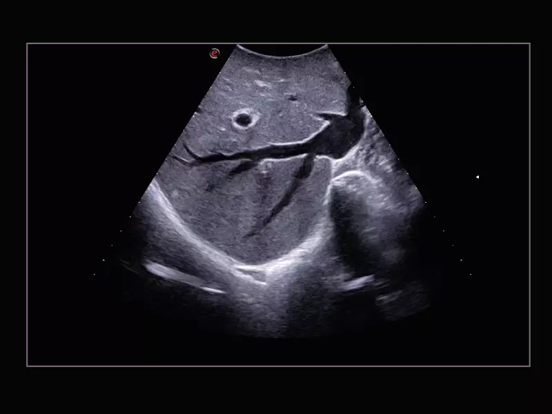 MyLab™X9 - General Imaging 01