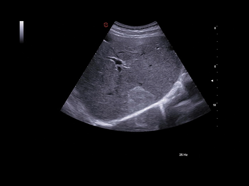 MyLab™A70 - Liver pathology