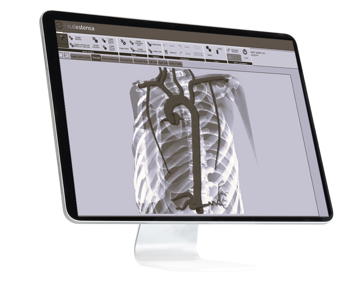 Suitestensa IR, enterprise imaging software