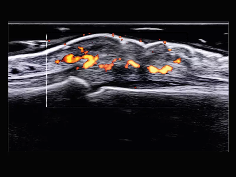 MyLab™X9 - Superficial 04