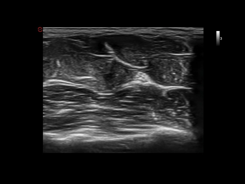 MyLab™X1 Go - General Imaging 01