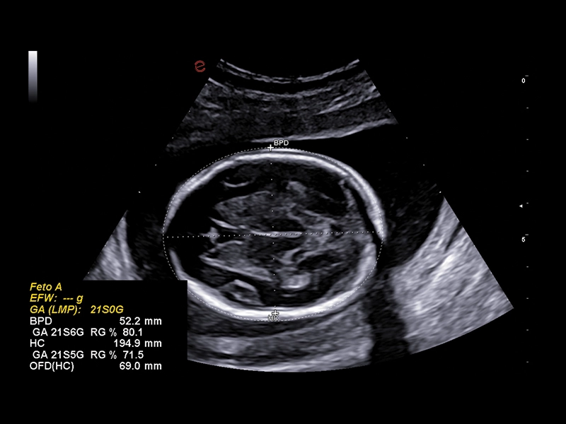 MyLab™A50 - autoOB