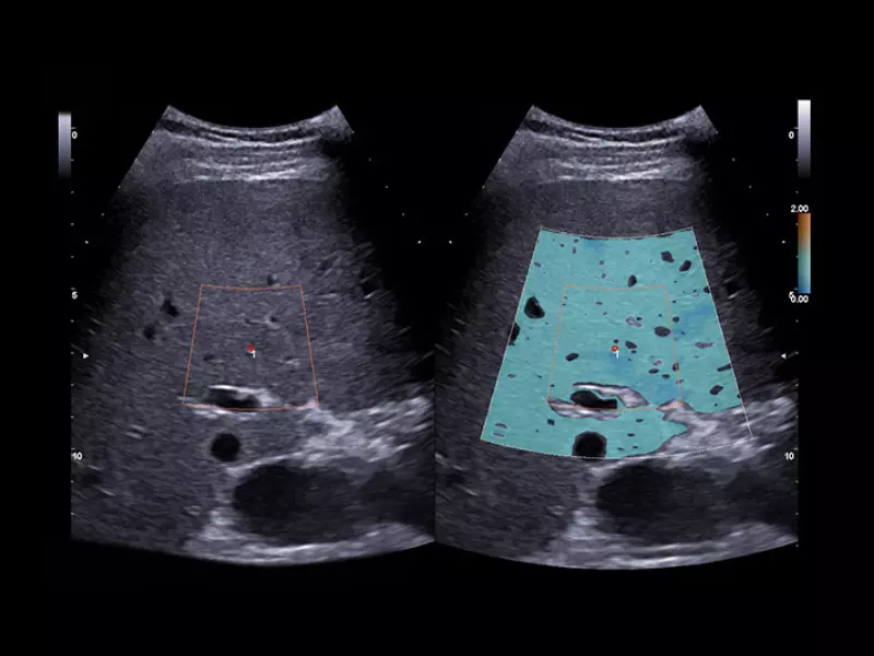 MyLab™X90 - Liver 04